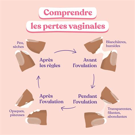 perte blanche|Pertes vaginales blanches et crémeuses : causes et。